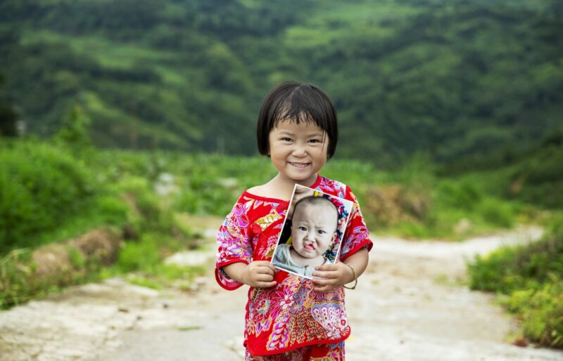 Girl in red outfit smiles as she holds a photo of herself before her cleft repair surgery