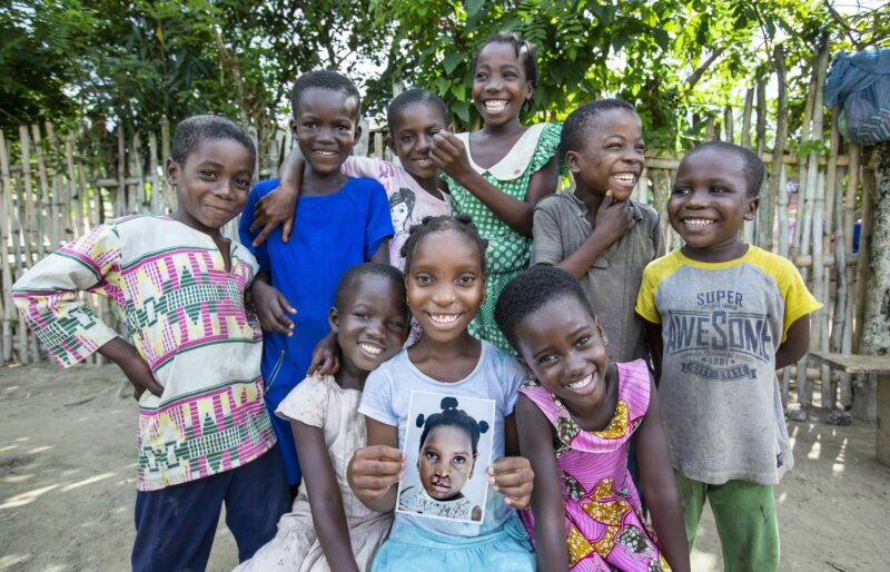 A young girl from Ghana smiling while holding a picture of herself before her cleft repair surgery. She is surrounded by a group of her friends who are smiling with her.